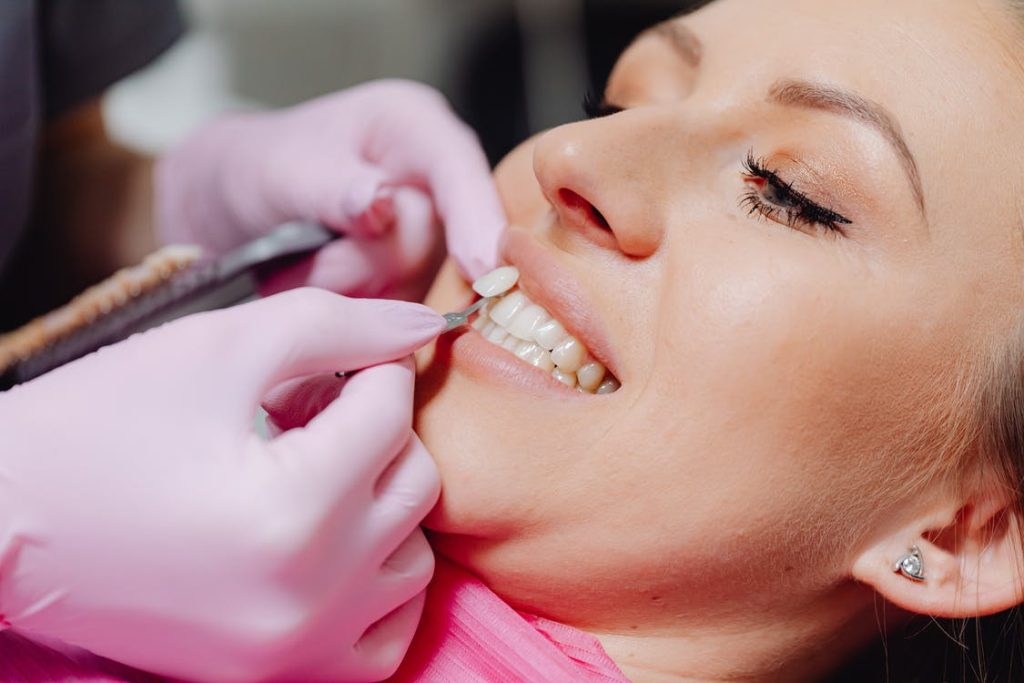 What to Expect Before Getting Dental Veneers
