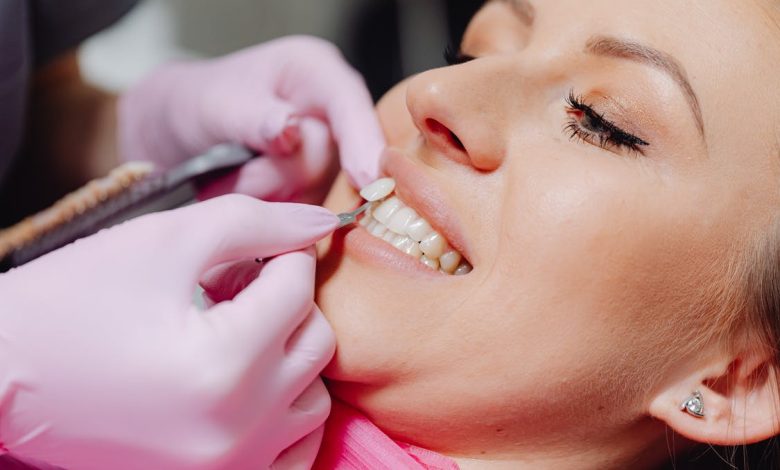 What to Expect Before Getting Dental Veneers