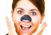 why-is-blackhead-removal-important?
