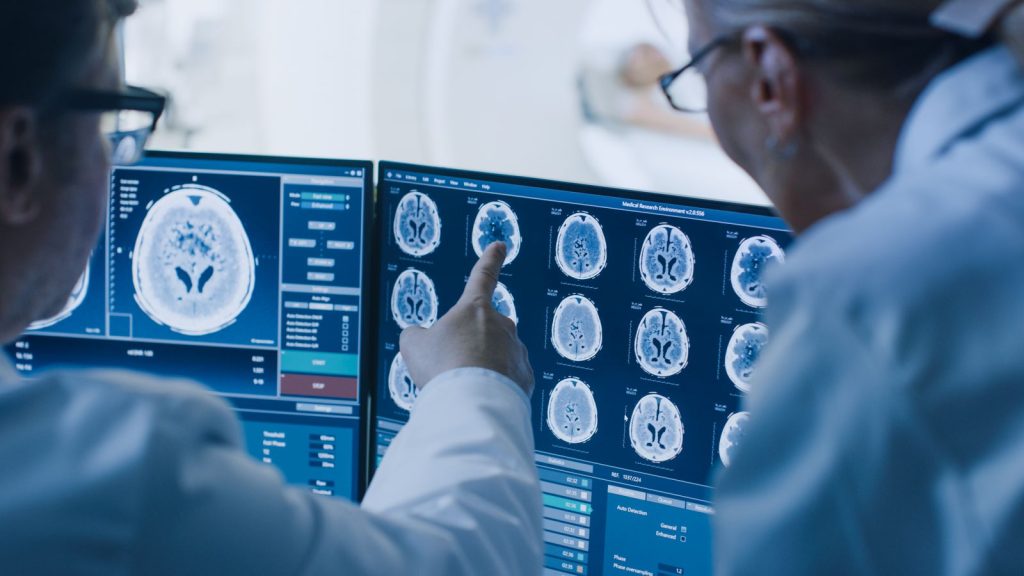 Brain Tumors, Types of Brain Tumors and cures